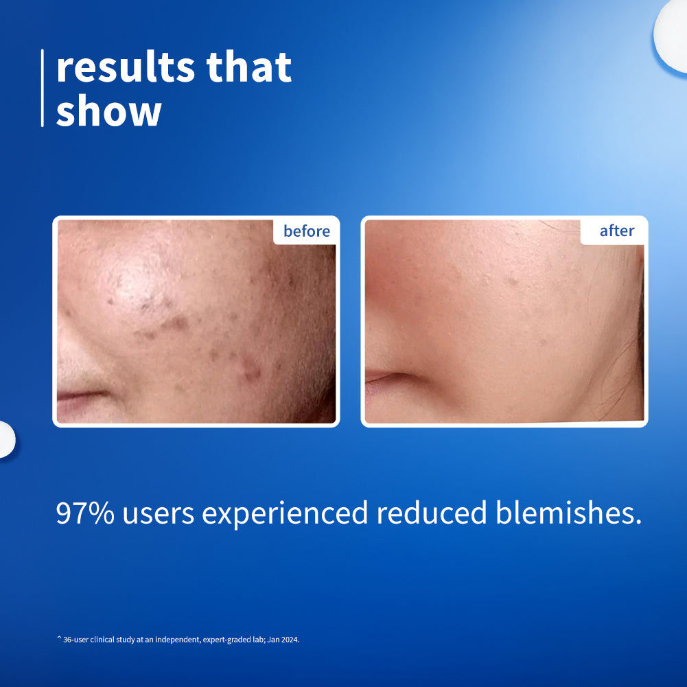 10% Niacinamide Face Serum with Rice Water For Clear & Bright Skin