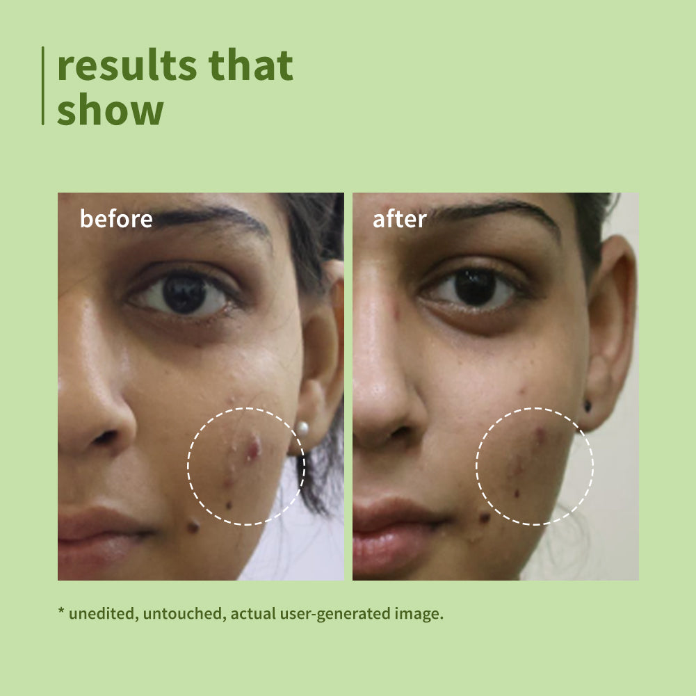 Green Tea Pore Cleansing Face Wash For Oily & Acne-Prone Skin