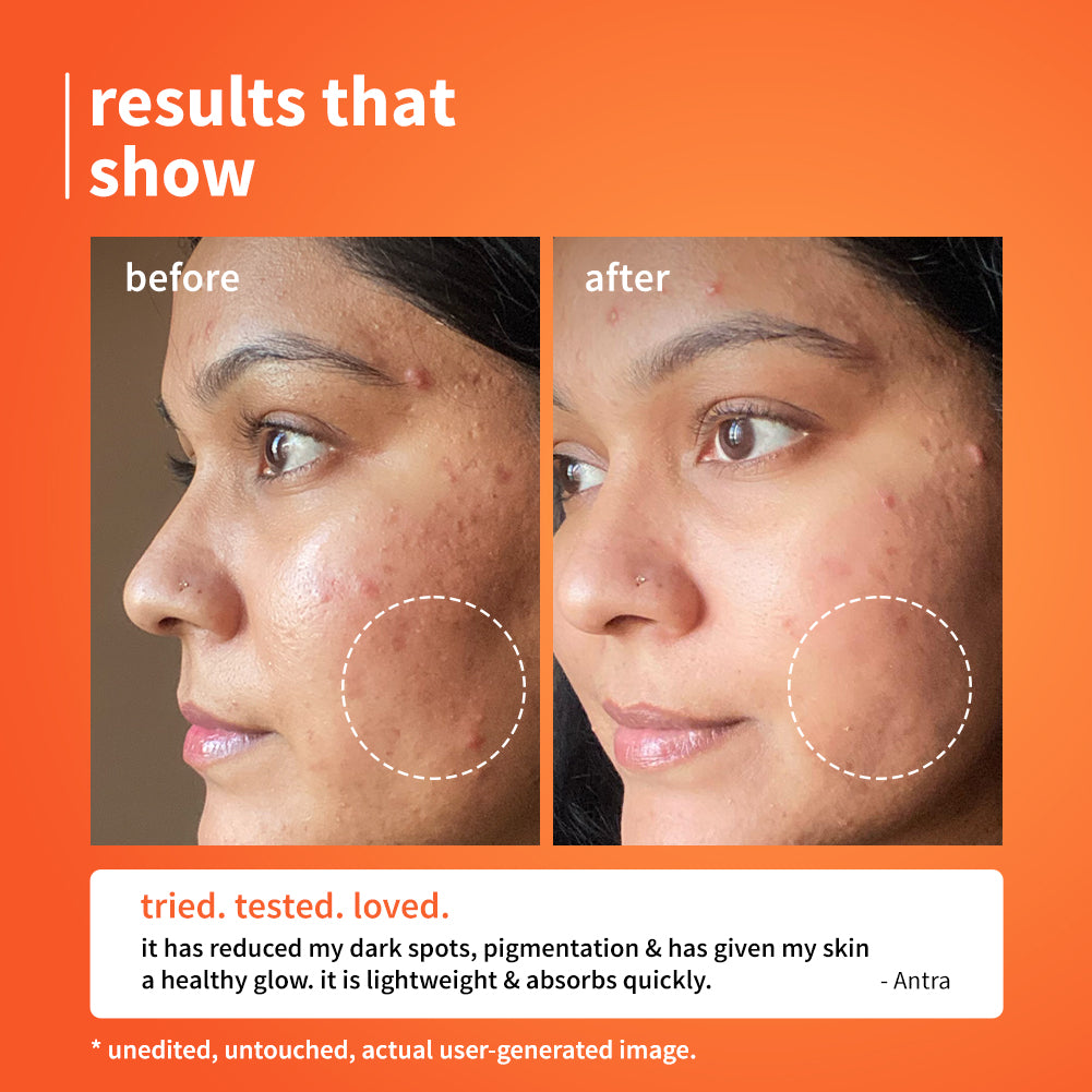 10% Vitamin C & Calendula Barrier Boosting + Glow Serum