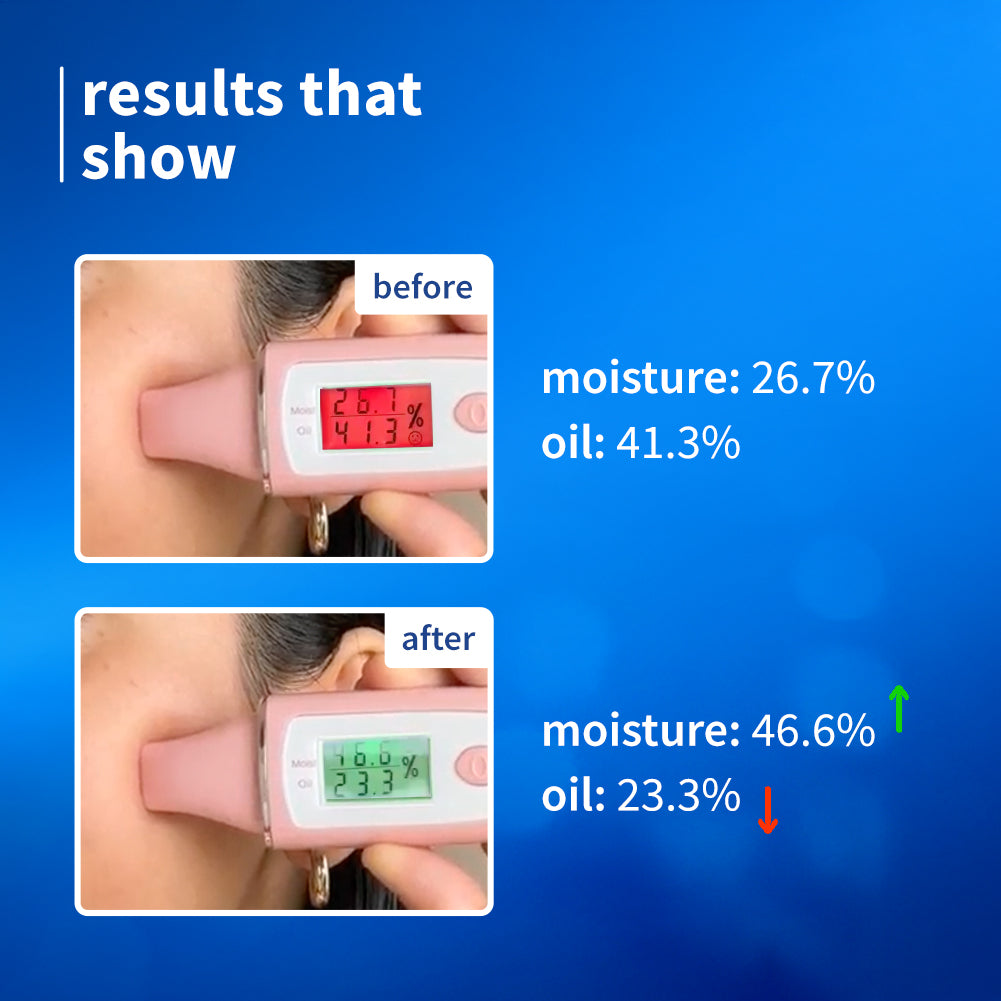 2% Niacinamide & Rice Water Brightening Gel Moisturizer For Clear & Bright Skin