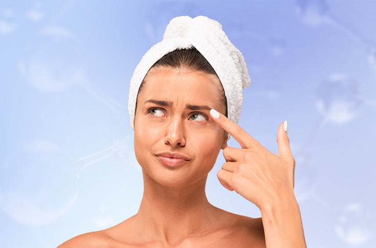 Removing blackheads