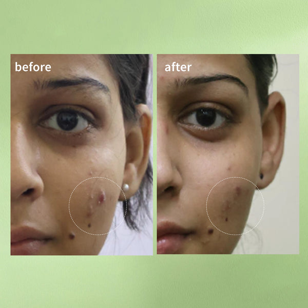 Clinical results