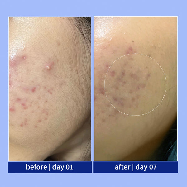 Clinical results
