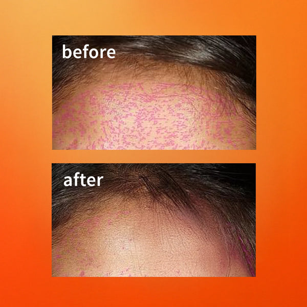 Clinical results